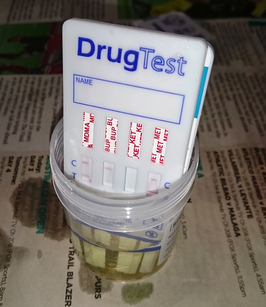 Inconclusive drug test results and what to do when an employee shows up